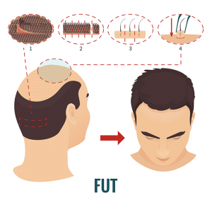 technique FUT tunisie