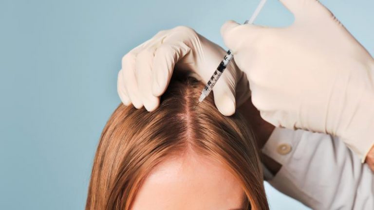 L’injection de PRP : Solution contre la chute de cheveux